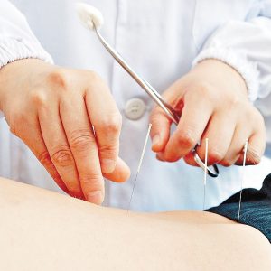 Agopuntura e Auricoloterapia